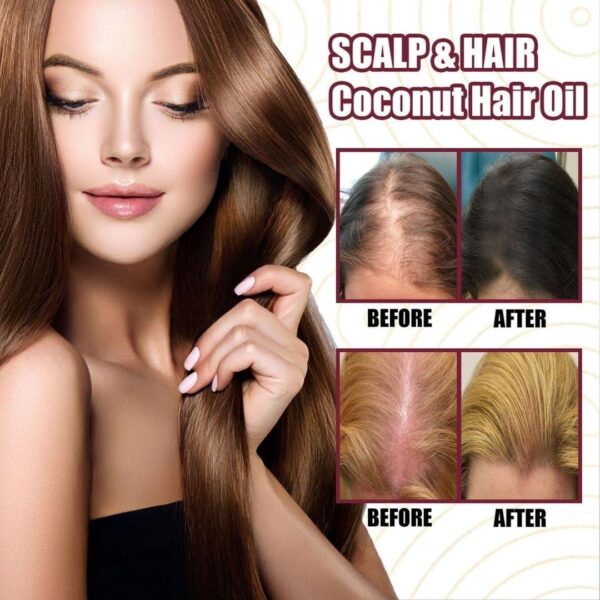 Onion Black Seed Hair Oil Spray Hair Care Growth Prevent - Image 4