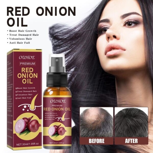 Onion Black Seed Hair Oil Spray Hair Care Growth Prevent