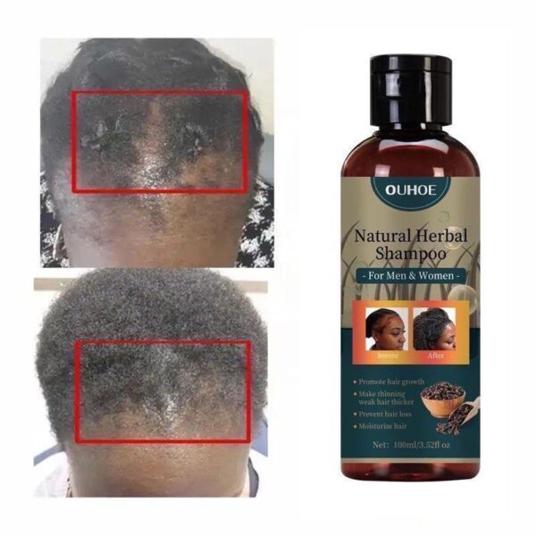 New2024 Chebe Hair Growth Shampoo Ancient African Hair Growth - Image 4