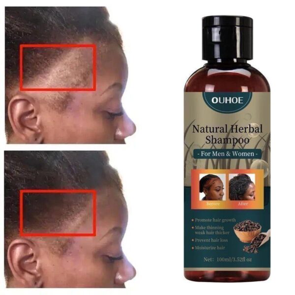 New2024 Chebe Hair Growth Shampoo Ancient African Hair Growth - Image 5